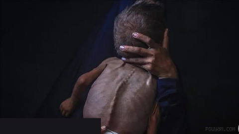 466 Palestinians, including 157 children, have died from malnutrition
