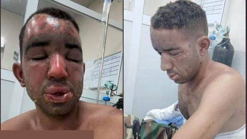 ⭕ پارت آزادی کوردستان : رژیم ایران در حمله پهپادی بامداد امروز از «فسفر سفید» استفاده کرده است