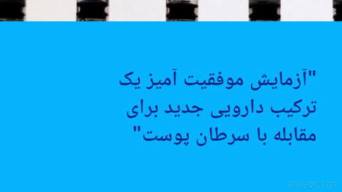 🔶 "آزمایش موفقیت آمیز یک ترکیب دارویی جدید برای مقابله با سرطان پوست"